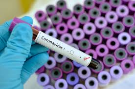 Villarrica, Pucón y Curarrehue mantienen aquietado aumento de contagios por coronavirus - Red Informativa