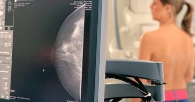 DSM Villarrica se suma al llamado a prevenir el Cáncer de mamas